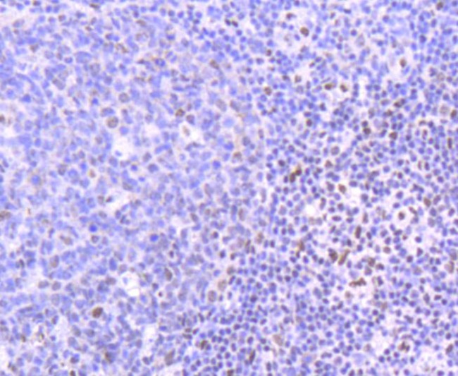 PIM1 Antibody in Immunohistochemistry (Paraffin) (IHC (P))