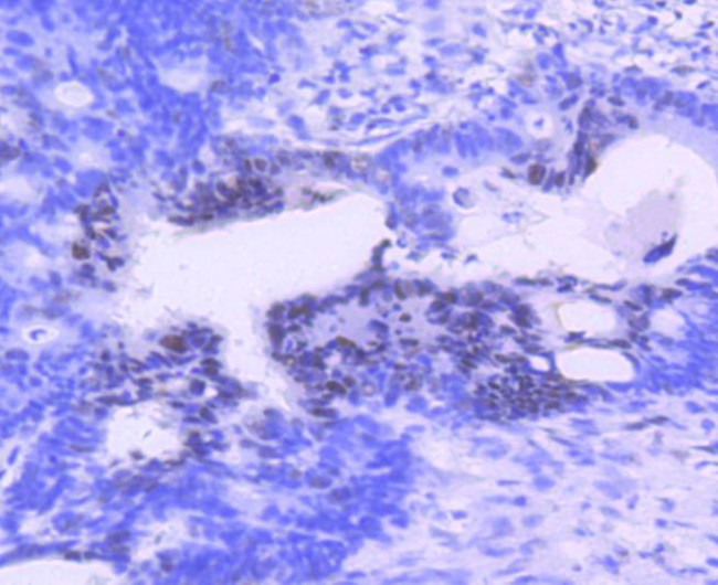 PIM1 Antibody in Immunohistochemistry (Paraffin) (IHC (P))