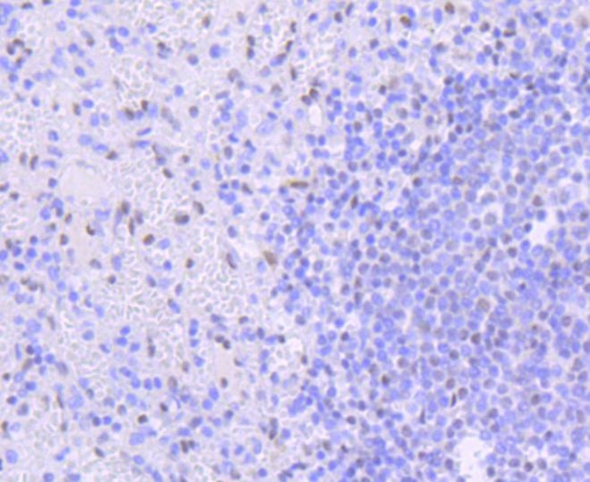 PIM1 Antibody in Immunohistochemistry (Paraffin) (IHC (P))