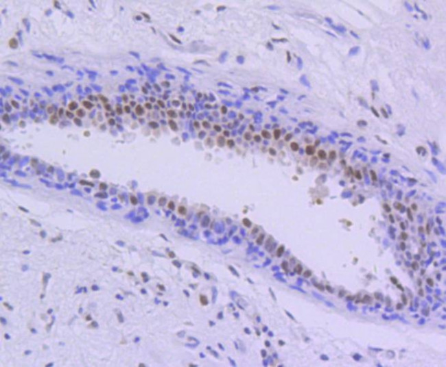 PIM1 Antibody in Immunohistochemistry (Paraffin) (IHC (P))