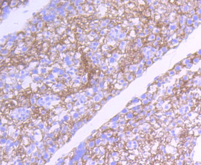 SRC Antibody in Immunohistochemistry (Paraffin) (IHC (P))