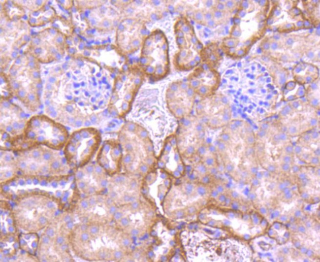 Pan-cadherin Antibody in Immunohistochemistry (Paraffin) (IHC (P))