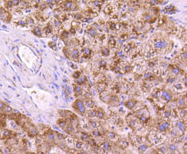 SGK1 Antibody in Immunohistochemistry (Paraffin) (IHC (P))