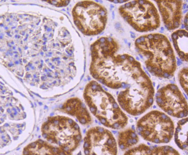 SGK1 Antibody in Immunohistochemistry (Paraffin) (IHC (P))