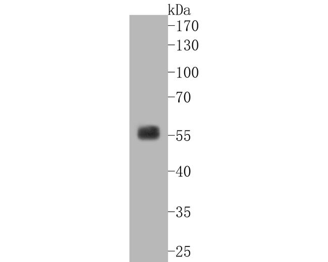 SGK1 Antibody in Western Blot (WB)