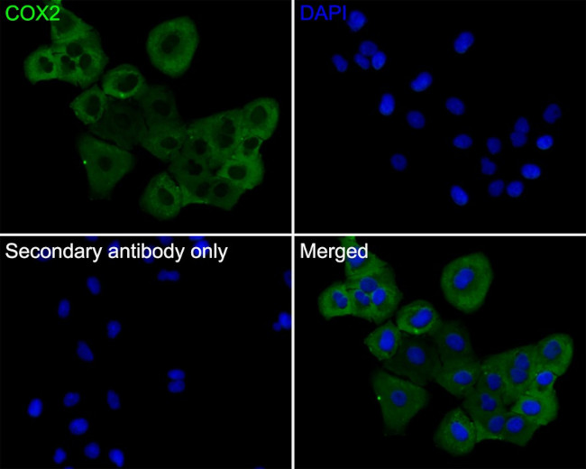 COX2 Antibody in Immunohistochemistry (Paraffin) (IHC (P))