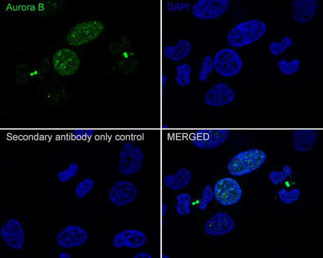 Aurora B Antibody in Immunocytochemistry (ICC/IF)