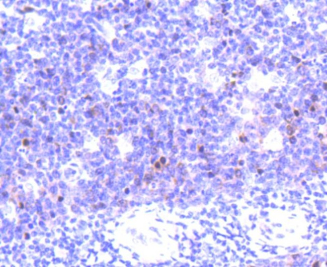 Aurora B Antibody in Immunohistochemistry (Paraffin) (IHC (P))