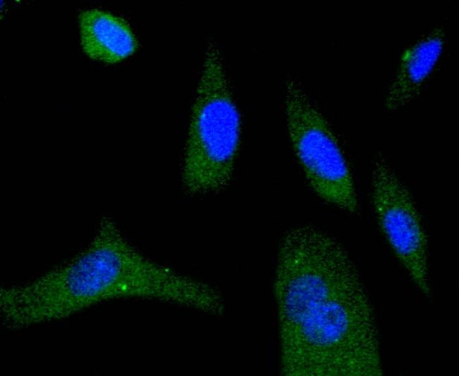 Phospho-eIF4E (Ser209) Antibody in Immunocytochemistry (ICC/IF)