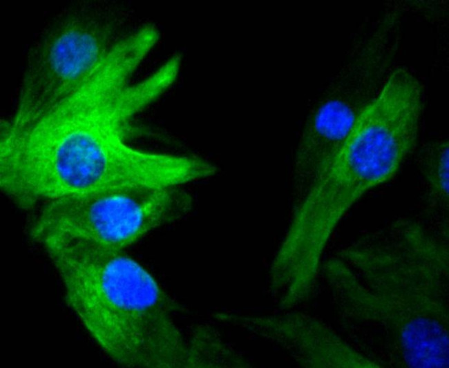 Vimentin Antibody in Immunocytochemistry (ICC/IF)