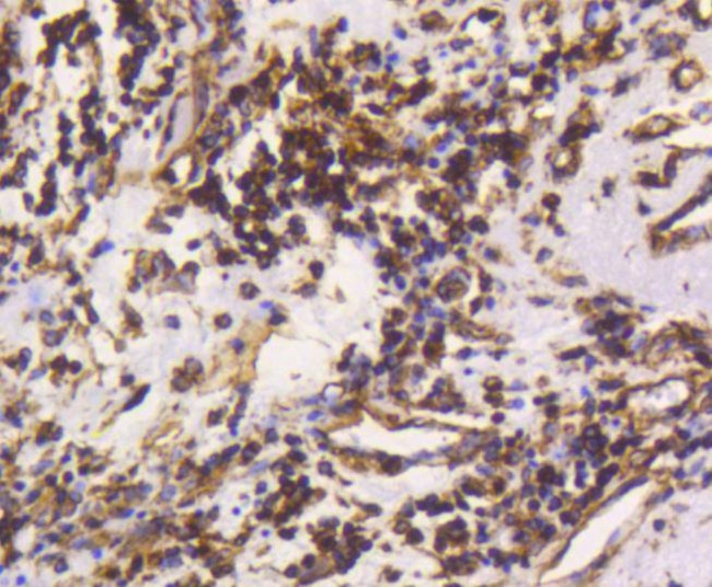 Vimentin Antibody in Immunohistochemistry (Paraffin) (IHC (P))