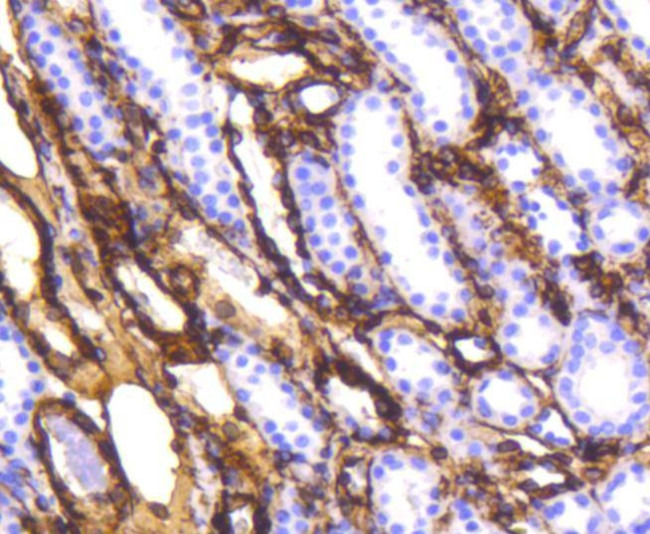 Vimentin Antibody in Immunohistochemistry (Paraffin) (IHC (P))