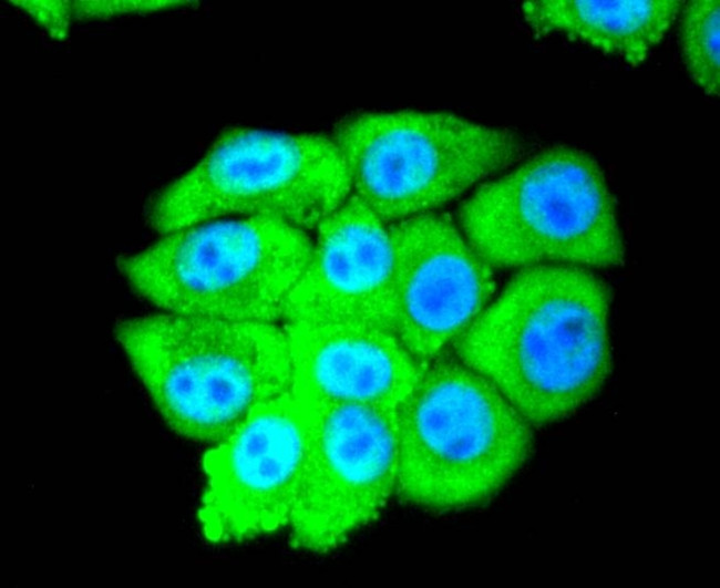 eIF5A Antibody in Immunocytochemistry (ICC/IF)