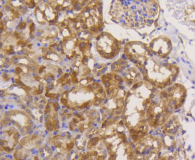 eIF5A Antibody in Immunohistochemistry (Paraffin) (IHC (P))