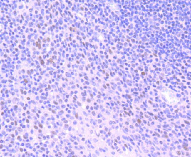 HDAC3 Antibody in Immunohistochemistry (Paraffin) (IHC (P))