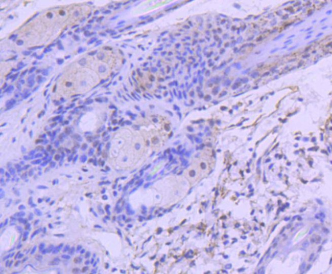 HDAC3 Antibody in Immunohistochemistry (Paraffin) (IHC (P))