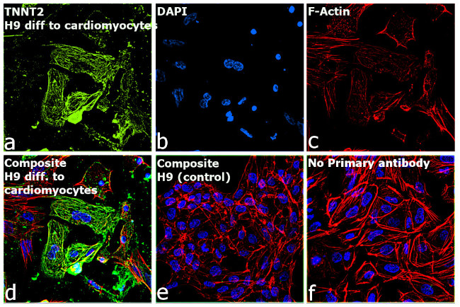 Cardiac Troponin T Antibody