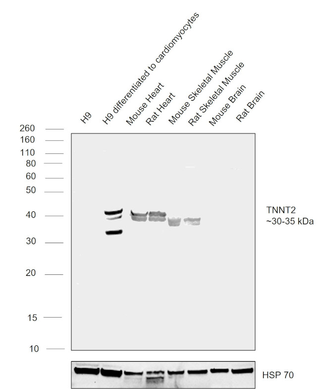 Cardiac Troponin T Antibody