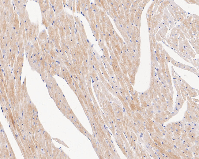 Cardiac Troponin T Antibody in Immunohistochemistry (Paraffin) (IHC (P))