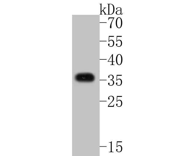 Cardiac Troponin T Antibody in Western Blot (WB)