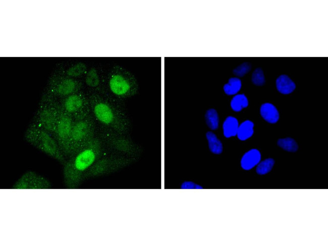 STAT5 alpha Antibody in Immunocytochemistry (ICC/IF)