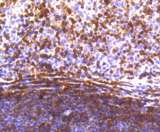 STAT5 alpha Antibody in Immunohistochemistry (Paraffin) (IHC (P))