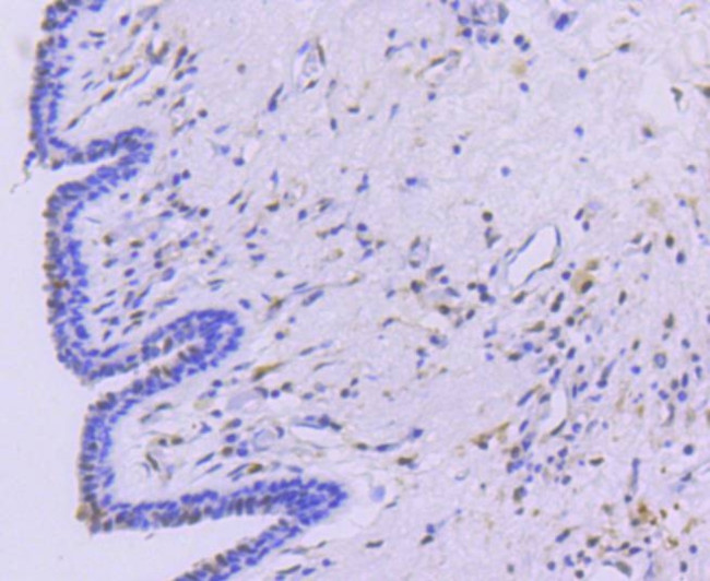 STAT5 alpha Antibody in Immunohistochemistry (Paraffin) (IHC (P))