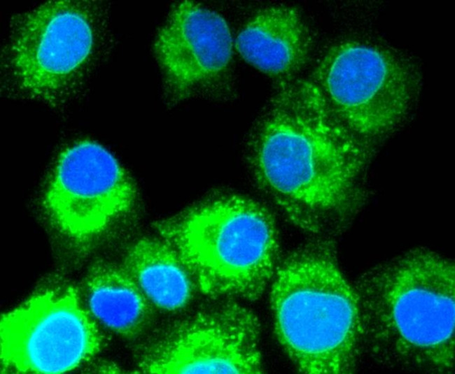 SHH Antibody in Immunocytochemistry (ICC/IF)