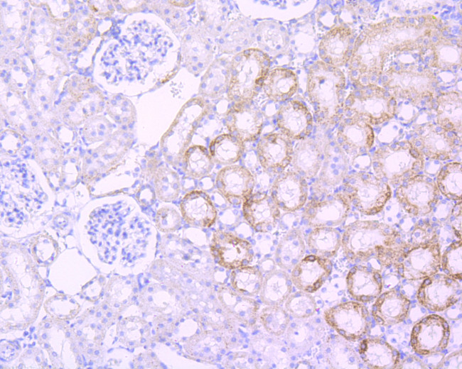 SHH Antibody in Immunohistochemistry (Paraffin) (IHC (P))