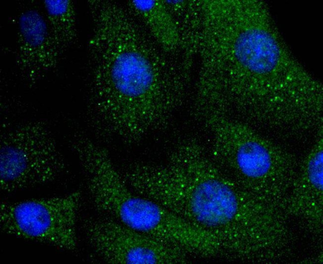 ILK Antibody in Immunocytochemistry (ICC/IF)