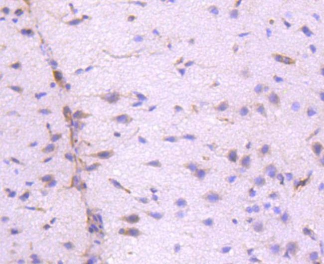 ILK Antibody in Immunohistochemistry (Paraffin) (IHC (P))