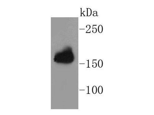 Protein APC Antibody in Western Blot (WB)