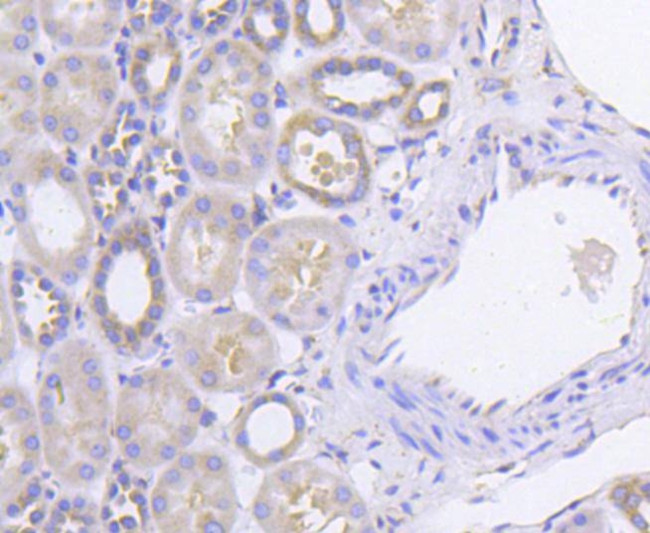 PKR Antibody in Immunohistochemistry (Paraffin) (IHC (P))