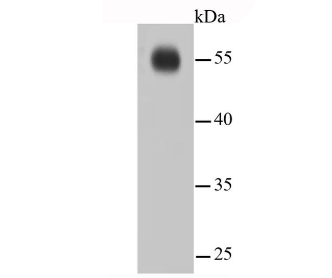 IRF7 Antibody in Western Blot (WB)