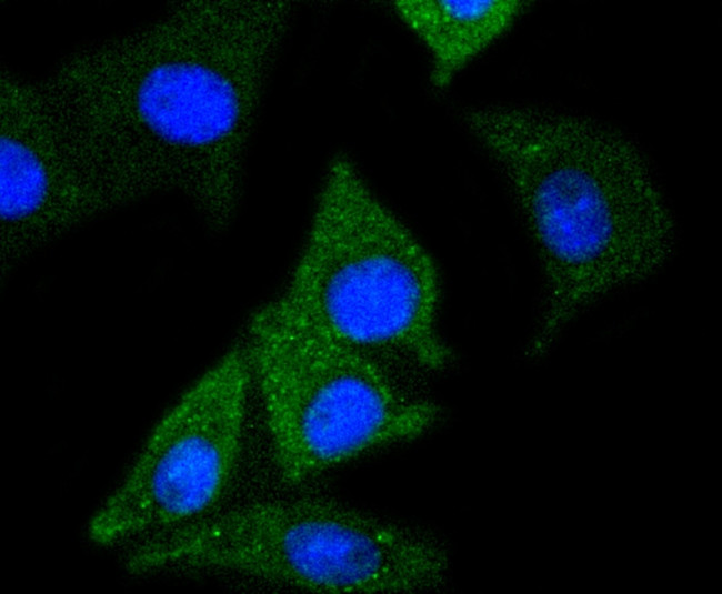 NSE Antibody in Immunocytochemistry (ICC/IF)