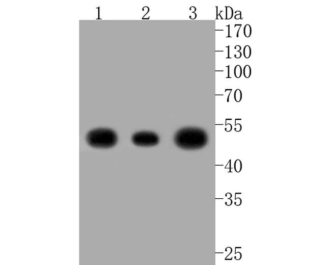 NSE Antibody in Western Blot (WB)