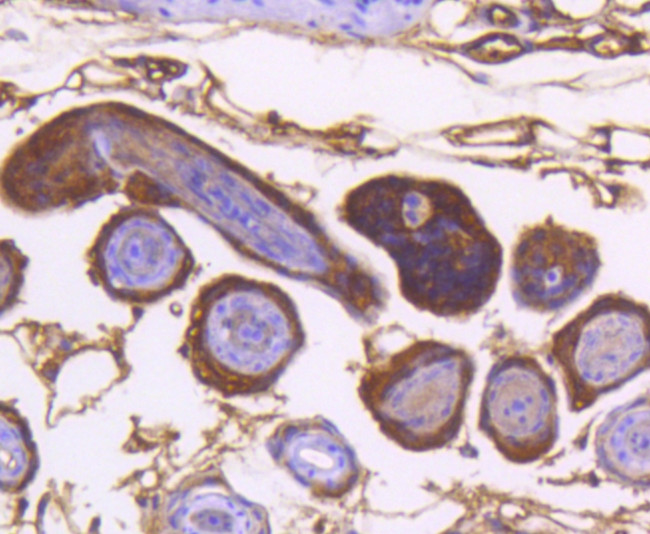 IKK alpha Antibody in Immunohistochemistry (Paraffin) (IHC (P))