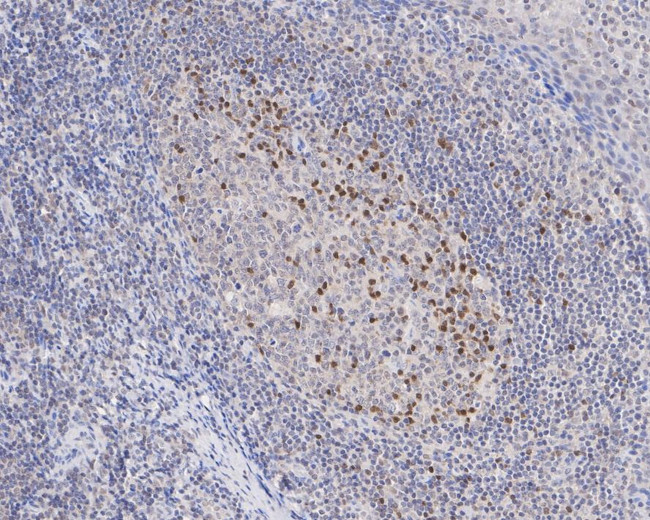 SHP2 Antibody in Immunohistochemistry (Paraffin) (IHC (P))