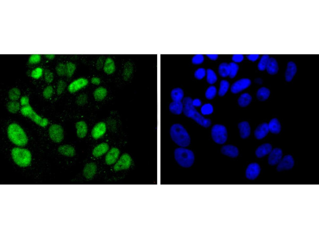 SOX9 Antibody in Immunocytochemistry (ICC/IF)