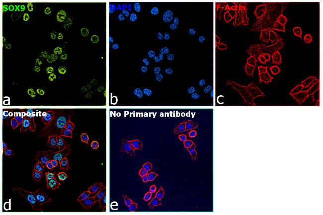 SOX9 Antibody in Immunocytochemistry (ICC/IF)