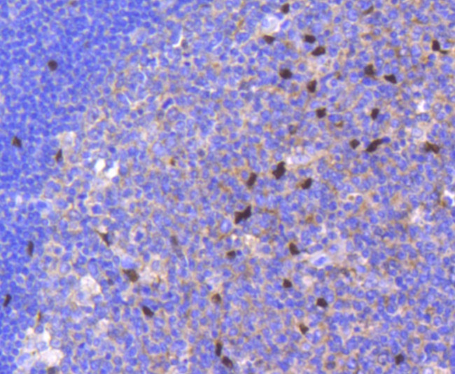 SOX9 Antibody in Immunohistochemistry (Paraffin) (IHC (P))