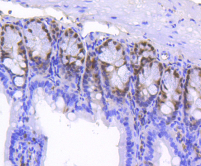 SOX9 Antibody in Immunohistochemistry (Paraffin) (IHC (P))