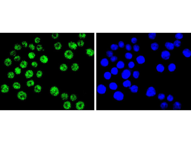 BRG1 Antibody in Immunocytochemistry (ICC/IF)