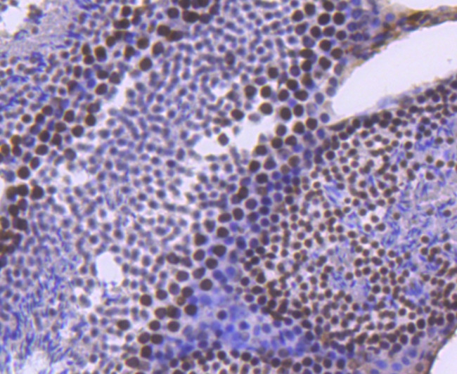 BRG1 Antibody in Immunohistochemistry (Paraffin) (IHC (P))