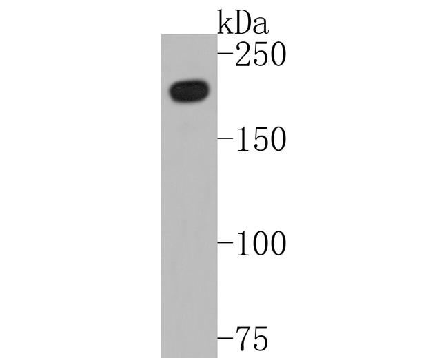 BRG1 Antibody in Western Blot (WB)