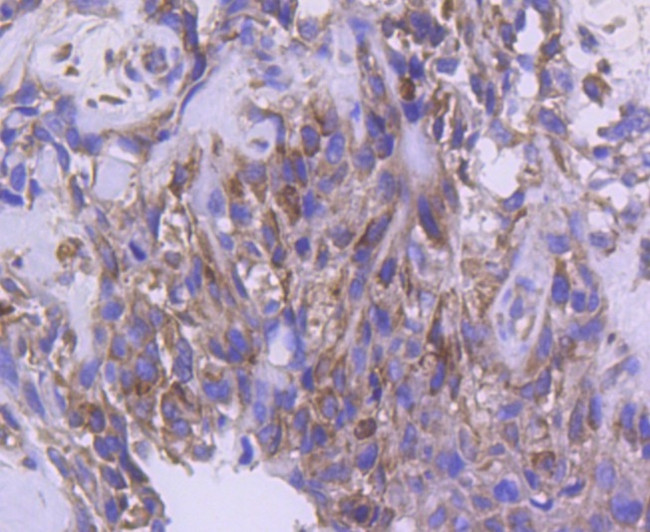 IRF5 Antibody in Immunohistochemistry (Paraffin) (IHC (P))