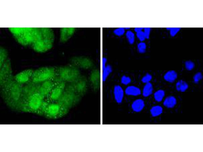 CDK4 Antibody in Immunocytochemistry (ICC/IF)