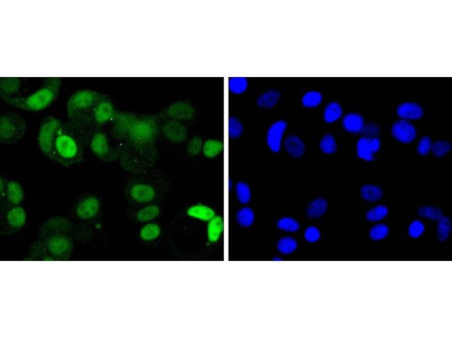 CDK4 Antibody in Immunocytochemistry (ICC/IF)