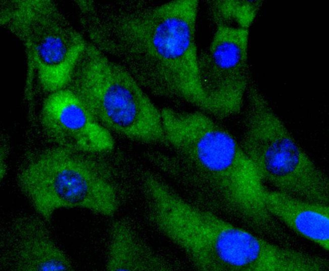 CDK4 Antibody in Immunocytochemistry (ICC/IF)