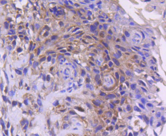 CDK4 Antibody in Immunohistochemistry (Paraffin) (IHC (P))